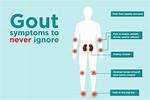 Does Pork Cause Gout?