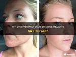 Does Pregnancy Cause Rough Face?