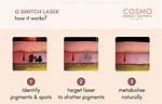 Does Q Switch Laser Work?