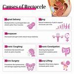 Does Rectocele Cause Bleeding?