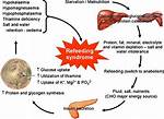 Does Refeeding Syndrome Cause Edema?