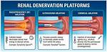 Does Renal Denervation Work?