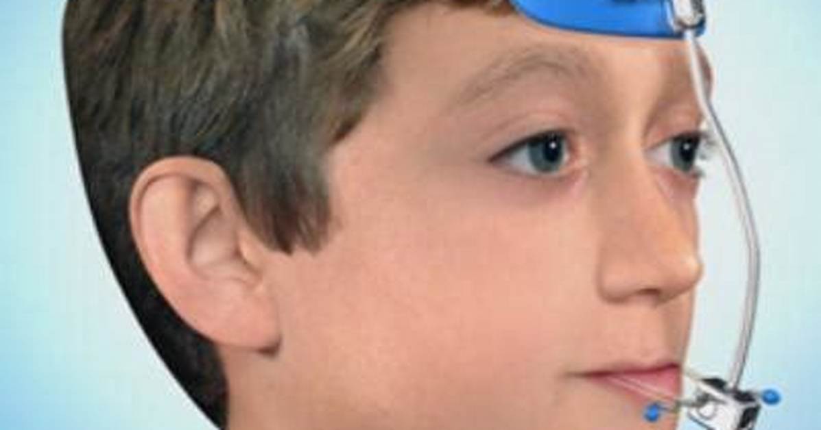 Does Reverse Pull Headgear Work?
