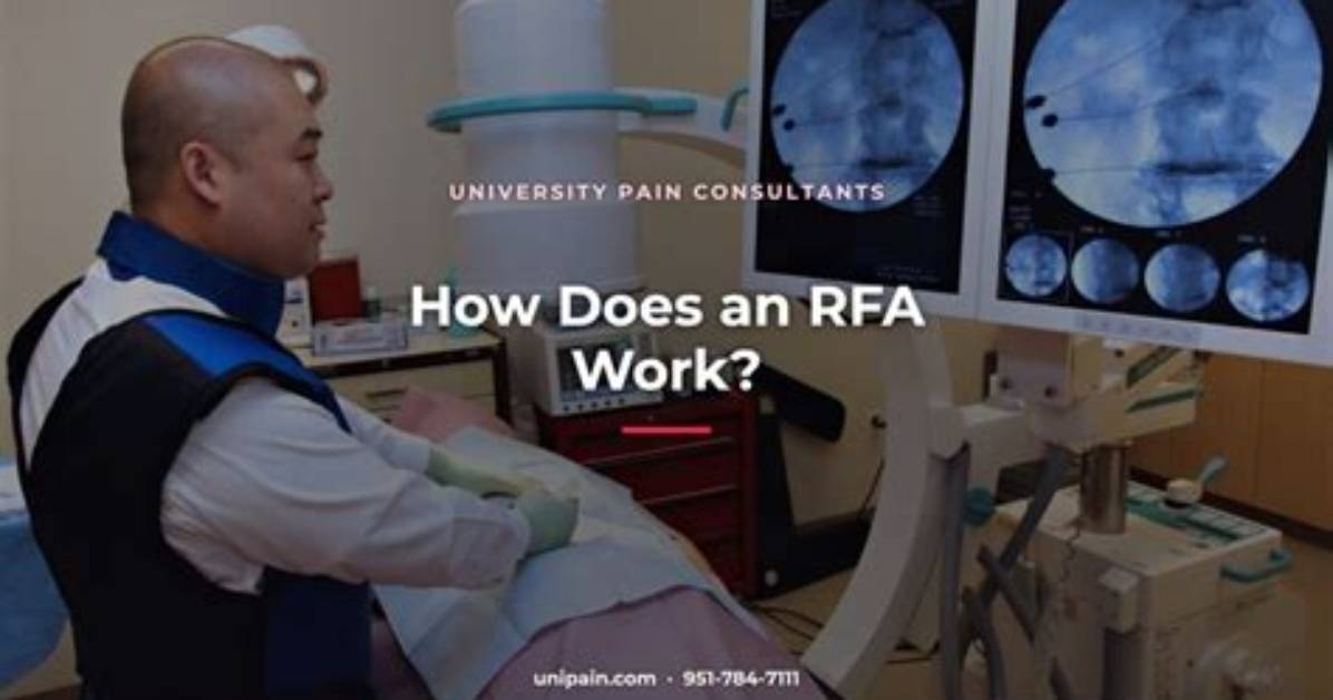Does Rfa Always Work?