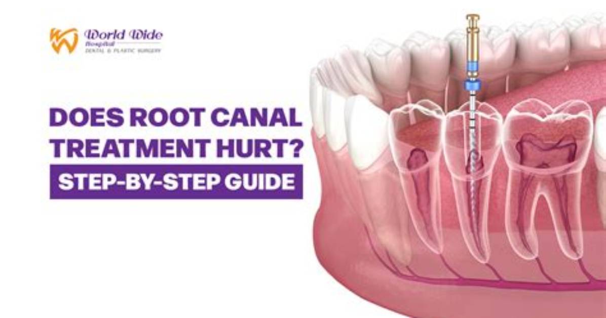 Does Root Canals Hurt?