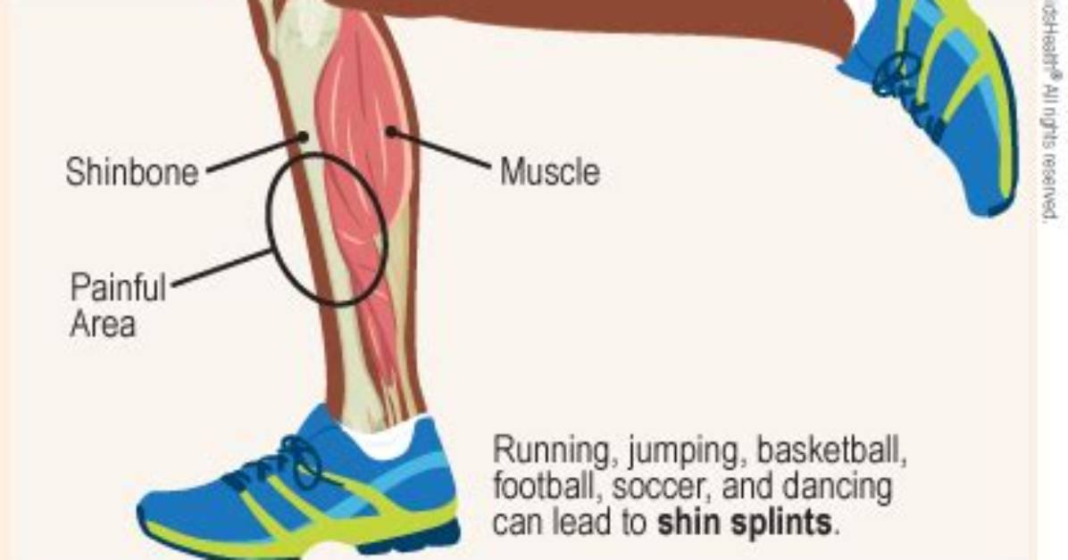 Does Running Condition Shins?