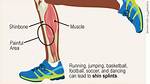 Does Running Condition Shins?