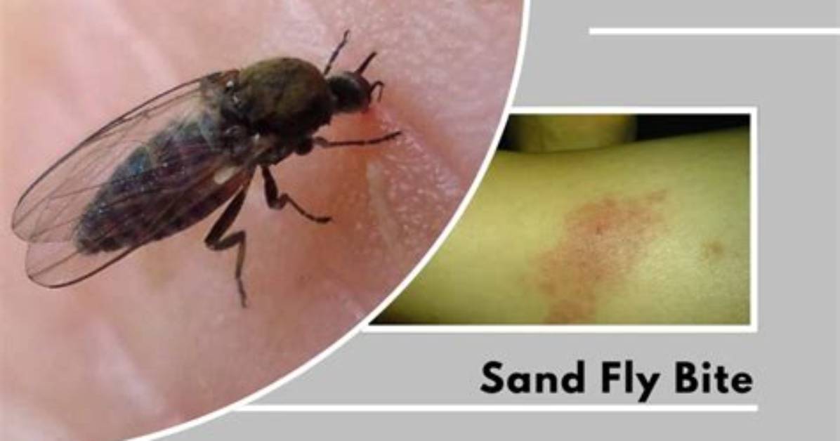 Does Sand Flies Bite?