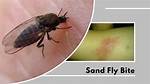 Does Sand Flies Bite?