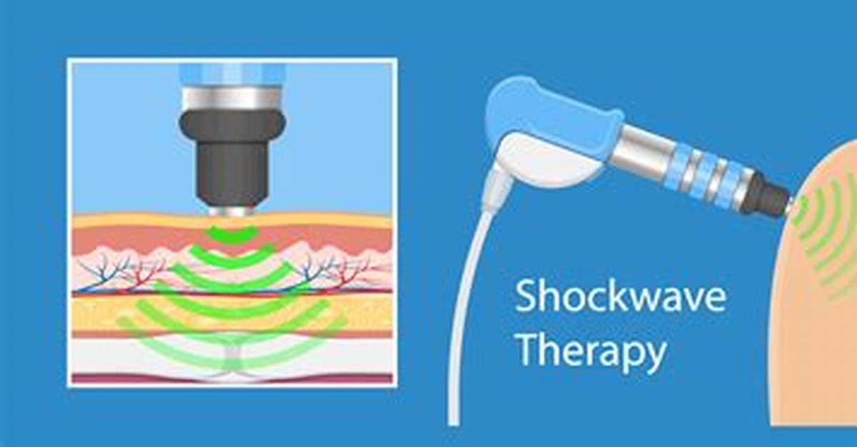 Does Shockwave Therapy Work?