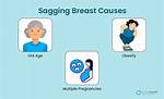 Does Skipping Cause Sagging Breasts?