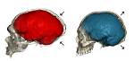 Does Skull Shape Affect Brain?