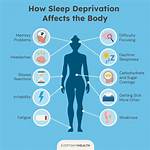 Does Sleep Affect Drunk?