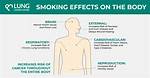 Does Smoking Cause Claudication?