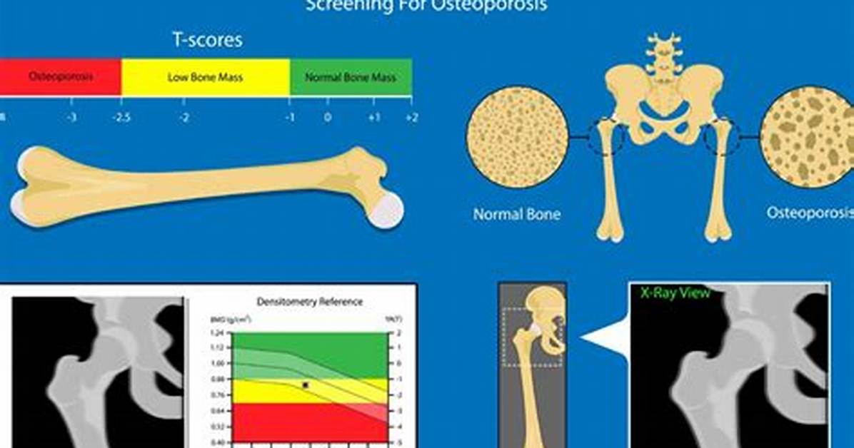 Does Solis Do Bone Density Test?