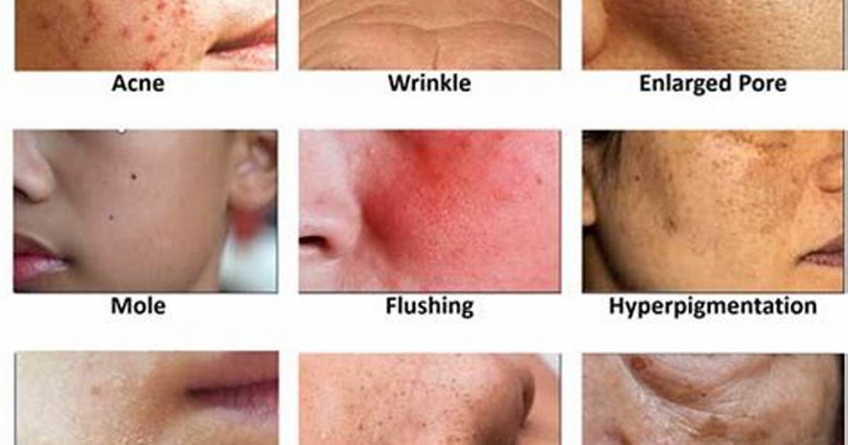 Does Solvents Cause Skin Problems?