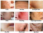 Does Solvents Cause Skin Problems?