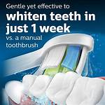 Does Sonicare Whiten Teeth?
