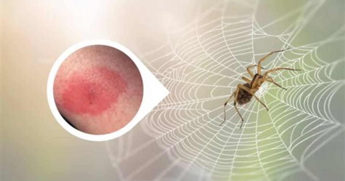 Does Spider Web Burn?