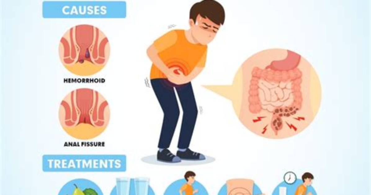 Does Steroids Cause Constipation?