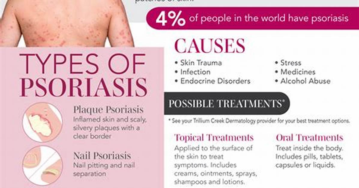 Does Streptococcus Cause Psoriasis?