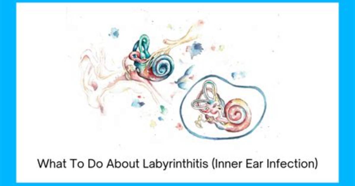 Does Stress Cause Labyrinthitis?