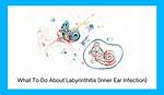 Does Stress Cause Labyrinthitis?