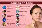 Does Stubble Cause Acne?
