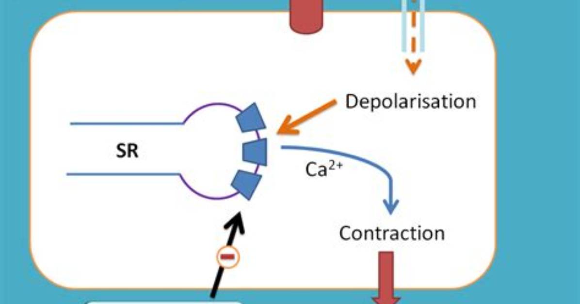 Does Succinylcholine Trigger Malignant Hyperthermia?