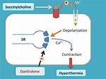 Does Succinylcholine Trigger Malignant Hyperthermia?