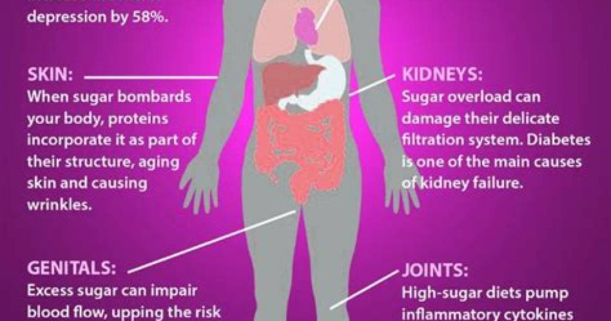 Does Sugar Cause Inflammation?