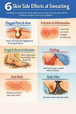 Does Sweating Cure Sickness?
