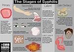 Does Syphilis Cause Discharge?
