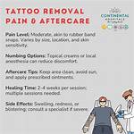 Does Temporary Tattoo Hurt?
