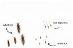 Does the Robi Comb Kill Eggs?