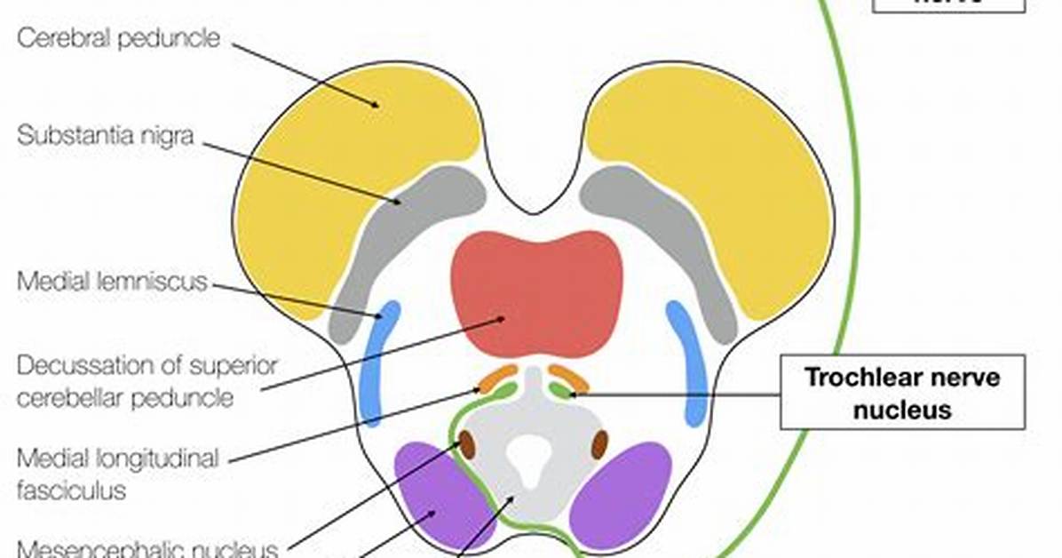 Does the Trochlear Nerve Decussate?