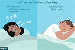 Does Thyroid Affect Sleep?