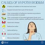 Does Thyroids Cause Headaches?