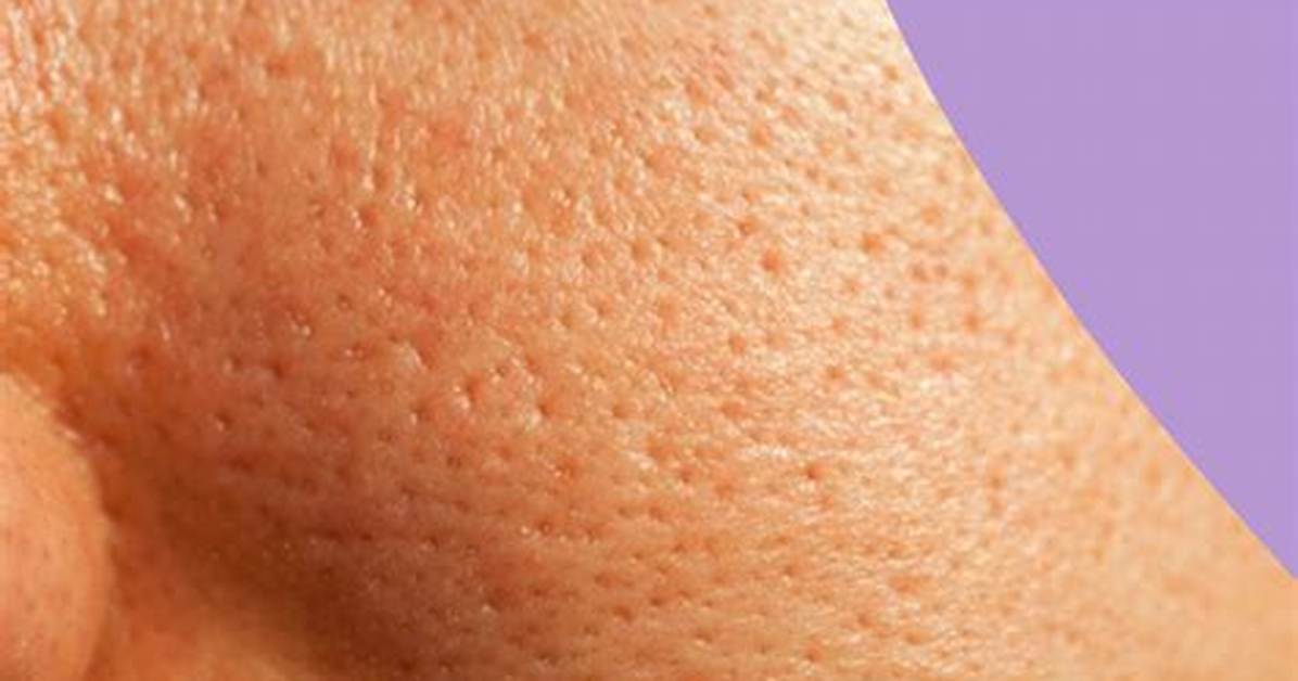 Does Tocopherol Clog Pores?