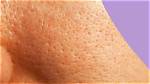 Does Tocopherol Clog Pores?