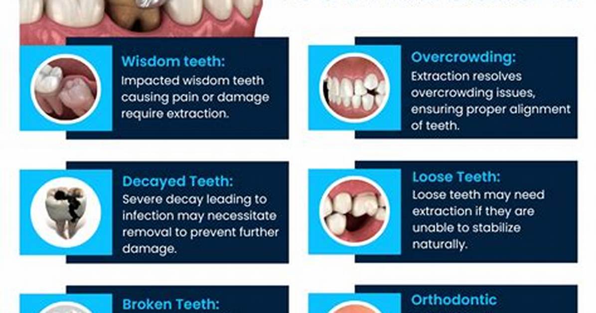 Does Tooth Extraction Hurt?