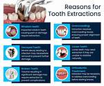 Does Tooth Extraction Hurt?
