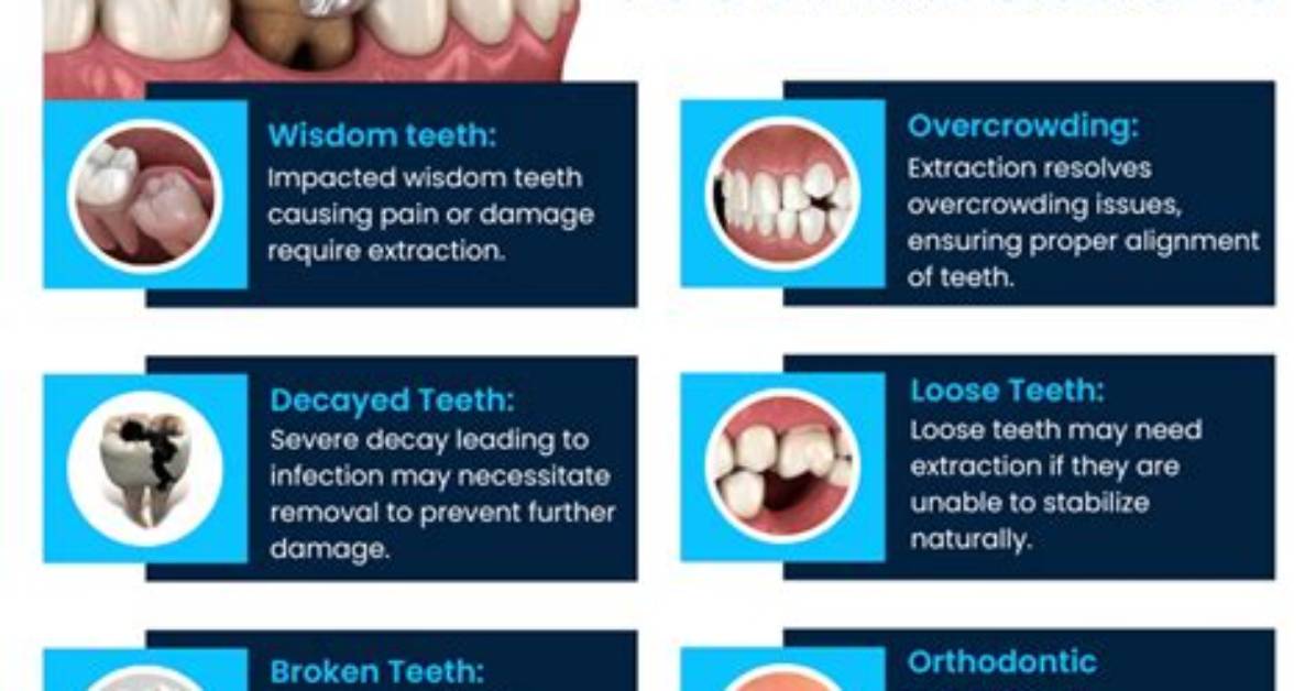 Does Tooth Pulling Hurt?