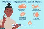Does Toothpaste Help Pimples