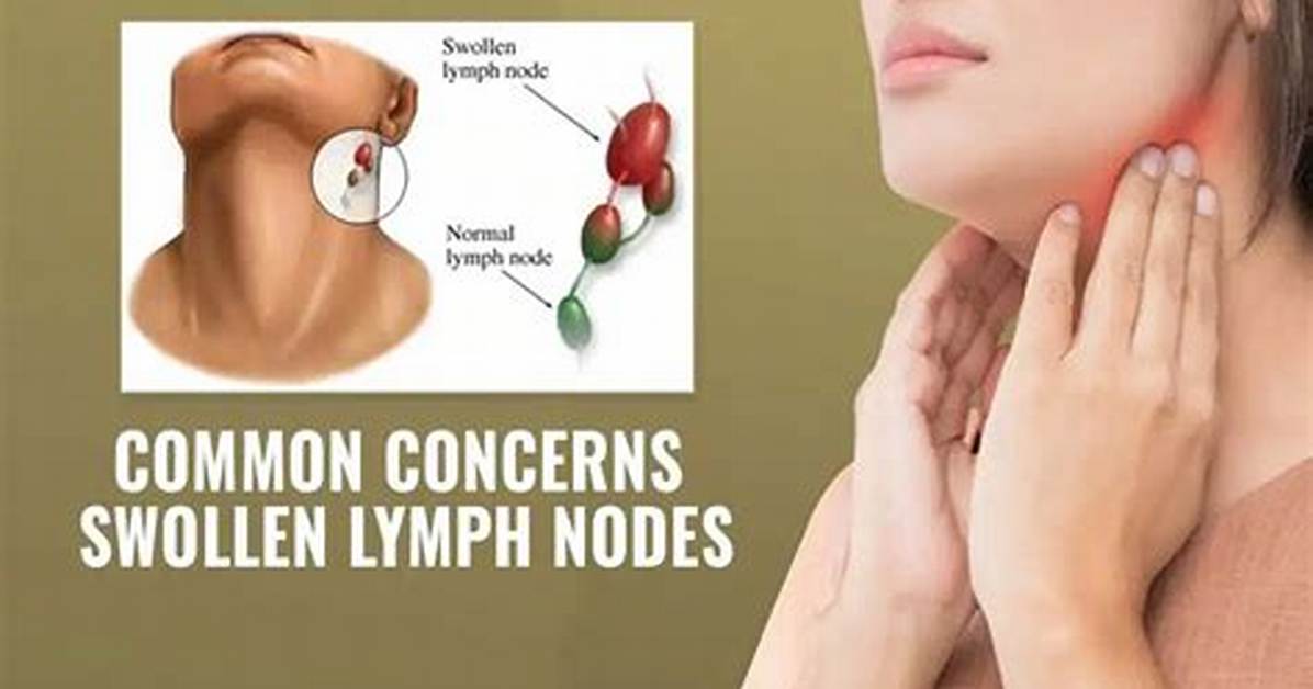 Does Touching Lymph Node Make Swell?