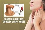 Does Touching Lymph Node Make Swell?