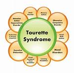 Does Tourettes Start Suddenly?