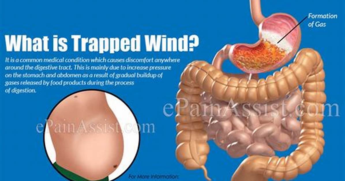 Does Trapped Wind Cause Nausea?