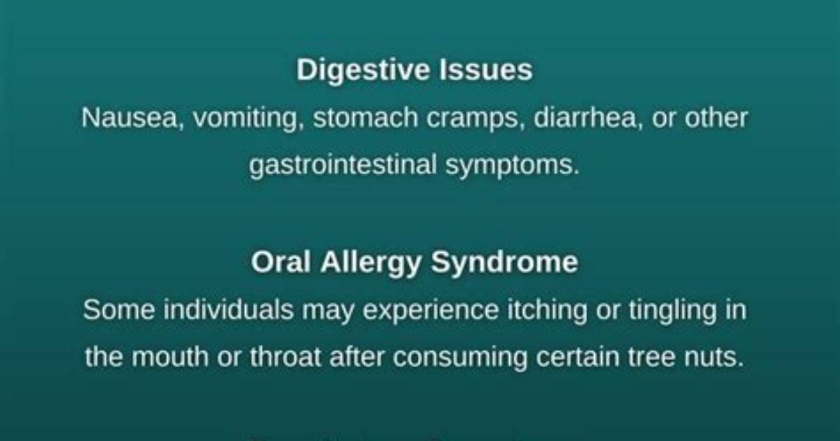 Does Tree Nut Allergy?
