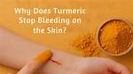 Does Turmeric Stop Bleeding?